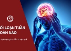 Rối loạn tuần hoàn não là gì? Cách phòng ngừa, điều trị hiệu quả